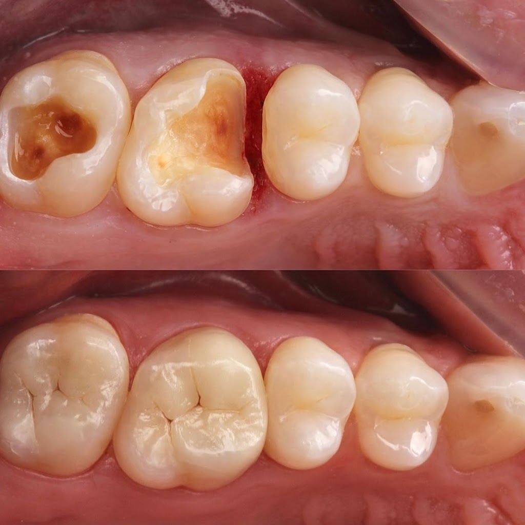 DENT 01 ÇENE CERRAHİSİ UZM. DR. Sadi Coşkun ve DİŞ HEKİMİ Görkem Güzel